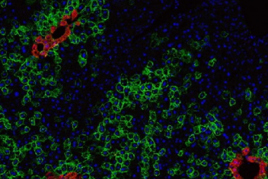 Tìm ra phương pháp kiểm tra độc tố mới bằng tế bào đơn lẻ
