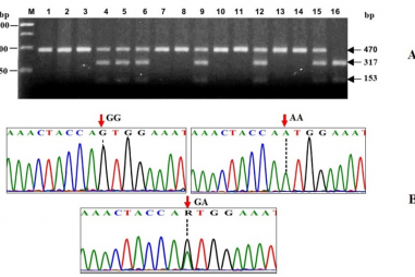 Tìm ra biến thể gen gây bệnh gút