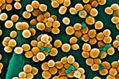 Mối liên quan giữa dị ứng thực phẩm, bệnh chàm và vi khuẩn