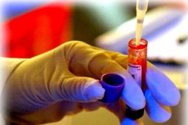 Xét nghiệm mới giúp chẩn đoán sớm ung thư gan