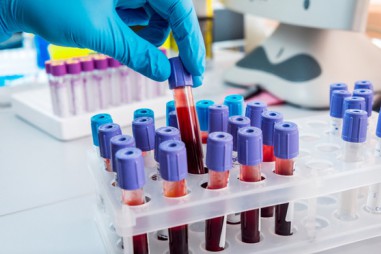 Xét nghiệm máu có thể dự đoán trước cái chết, độ chính xác tới 83%