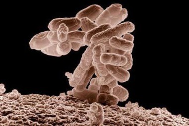 Phát hiện loại vi khuẩn đặc biệt… quanh khu định cư của người Ireland cổ đại