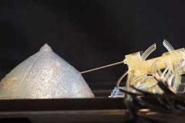 Trí tuệ nhân tạo có thể chẩn đoán ung thư hiệu quả như con người