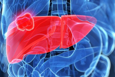 Phát hiện sớm ung thư gan bằng cách nào?