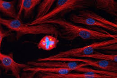 Điều gì sẽ xảy ra nếu con người tìm được phương pháp chữa khỏi Ung thư?