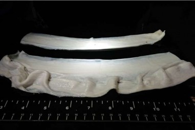 Phát triển tế bào sợi cơ trong thịt nuôi cấy nhân tạo