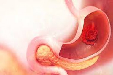 Nghiên cứu độc tính của bài thuốc DDHV điều trị viêm loét dạ dày do vi khuẩn HELICOBACTER PYLORI trên thực nghiệm