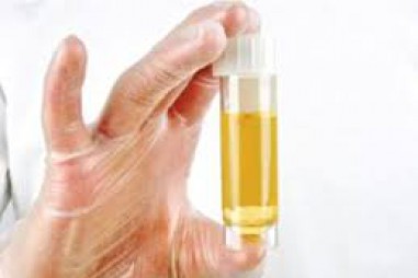 Xét nghiệm nước tiểu tại nhà phát hiện sớm ung thư tiền liệt tuyến