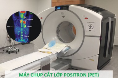 Các bác sĩ dùng chất phóng xạ để phát hiện tế bào ung thư như thế nào?