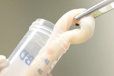 Tế bào gốc từ dây rốn có thể điều trị suy tim