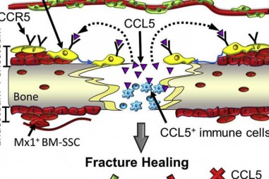 Tế bào gốc màng đáy - yếu tố chính đóng góp cho quá trình lành xương