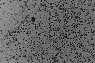 Các nhà khoa học Thụy Sỹ phát hiện sức mạnh chống virus của đường