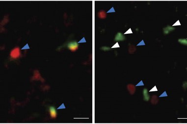 Kích hoạt các tế bào miễn dịch để hồi sinh bộ não đã lão hóa