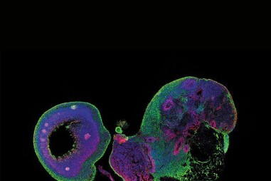 Nuôi cấy cơ quan nội tạng siêu nhỏ