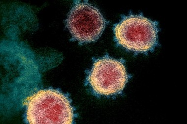 Bản đồ 3D hé lộ cơ chế lây nhiễm của nCoV