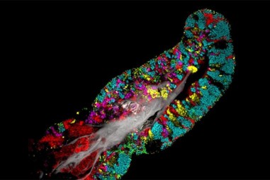 Vi khuẩn phủ kín lưỡi người