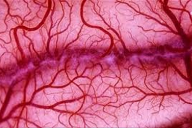 Mạch máu xấu - Nguyên nhân của bệnh tật và sự suy giảm tuổi thọ