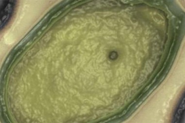 Phát hiện virus khổng lồ nhất thế giới