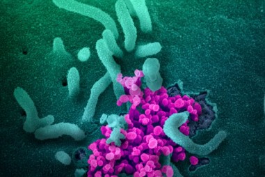 Tìm thấy một protein "phản loạn" trong cơ thể, kẻ mở cổng thành đón giặc SARS-CoV-2 vào trong tế bào