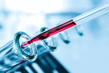 Phương pháp mới giúp phát hiện hơn 50 loại ung thư