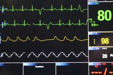 AI – Dụng cụ mới để chẩn đoán tim mạch