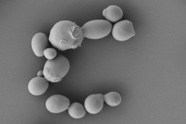 Sử dụng nấm men để tái tạo SARS-CoV-2: Thay đổi cách tiếp cận trong phân lập virus