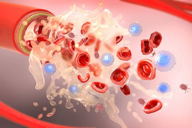 Theo dõi độ nhớt của huyết tương COVID-19