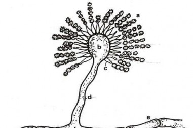 Các nhà khoa học phát hiện ra nấm lai Aspergillus Latus kháng thuốc có liên quan đến nhiễm trùng phổi ở một số bệnh nhân COVID-19