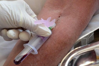 Xét nghiệm máu có thể dò được ung thư nhiều năm trước khi có triệu chứng