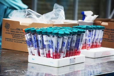 Gộp nhóm xét nghiệm Covid-19: Khi nào nên áp dụng