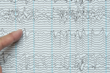 Dự đoán sớm chứng tự kỷ ở trẻ