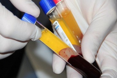 Dùng huyết tương người mắc COVID-19 đã khỏi: Niềm hy vọng của Việt Nam trong cuộc chiến chống đại dịch