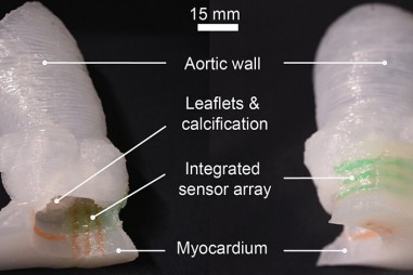 Mô hình van tim được in bằng công nghệ 3D