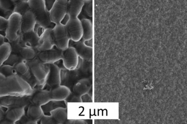 Vật liệu sinh học mới làm từ tơ nhện ngăn ngừa nhiễm trùng và hơn thế nữa