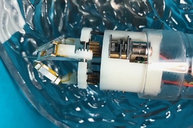 Dùng công nghệ in 3D sinh học điều trị tổn thương dạ dày