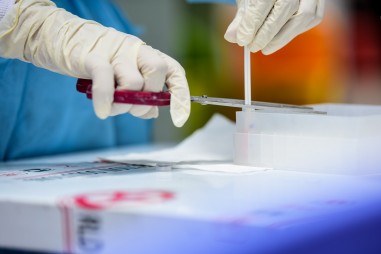 Bài toán xét nghiệm trong bối cảnh mới