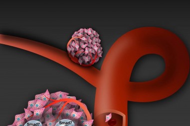 Nghiên cứu mới về cách để ung thư tuyến tiền liệt có thể di căn