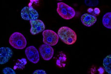 Tàu ngầm nano vận chuyển thuốc vào tế bào