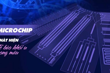 Microchip phát hiện tế bào khối u trong máu