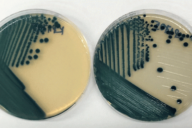 Sản xuất thành công đĩa thạch chẩn đoán nhiễm khuẩn đường ruột