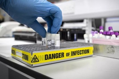 Virus SARS-CoV-2 có cơ chế xâm nhập phức tạp