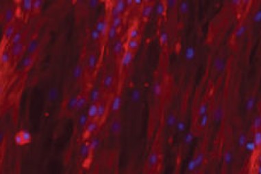 Công nghệ lai ghép hydrogel mở đường cho kỹ thuật mô nhân tạo