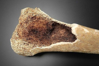 Vật liệu sinh học đột phá mới có thể khôi phục tất cả các yếu tố mô xương