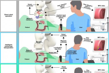 Nội soi bằng robot thông minh