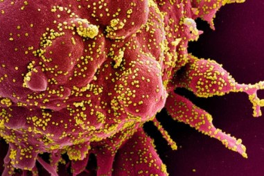 Gen nào quyết định mức độ mắc Covid-19 nặng hay nhẹ?