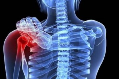 Dược chất phóng xạ chẩn đoán ung thư xương