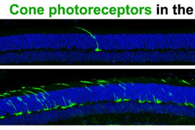 Mục tiêu mới cho phát triển thuốc cho bệnh loạn dưỡng võng mạc