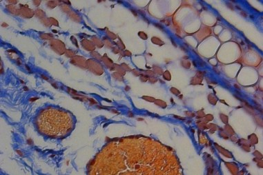 Sử dụng ánh sáng, tế bào hồng cầu và Peptide của ong mật để cung cấp protein trị liệu