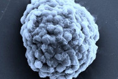 Công nghệ vi sinh vật sản xuất hydro qua quá trình quang hợp