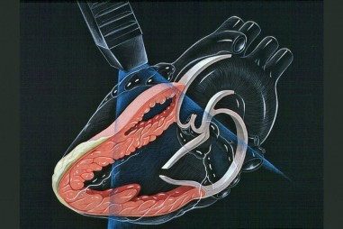 In sinh học 3D giúp nghiên cứu tim người